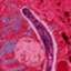 Plasmodium_falciparum